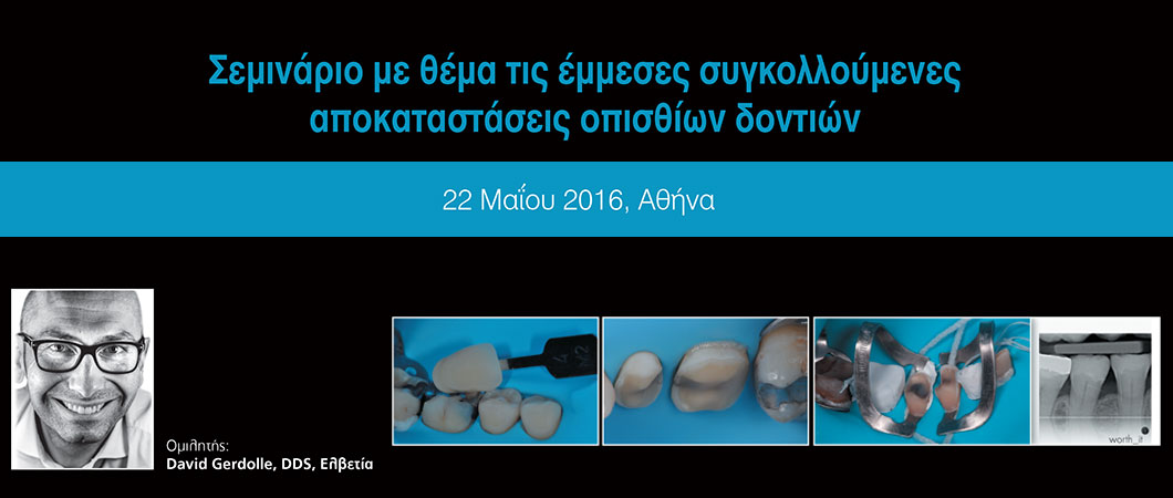 Σεμινάριο με θέμα τις έμμεσες συγκολλούμενες αποκαταστάσεις οπισθίων δοντιών - Omnipress