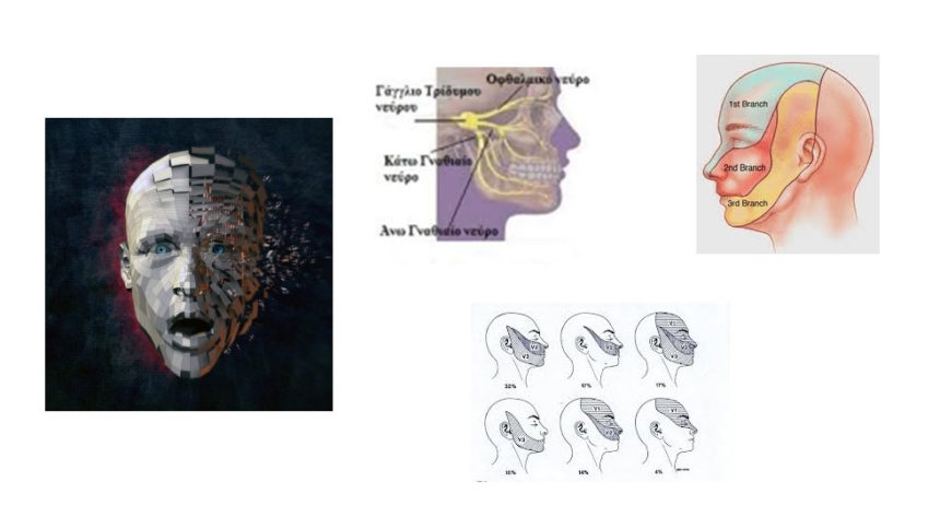 Νευραλγία Τριδύμου - Ένας από τους χειρότερους πόνους του ανθρώπου