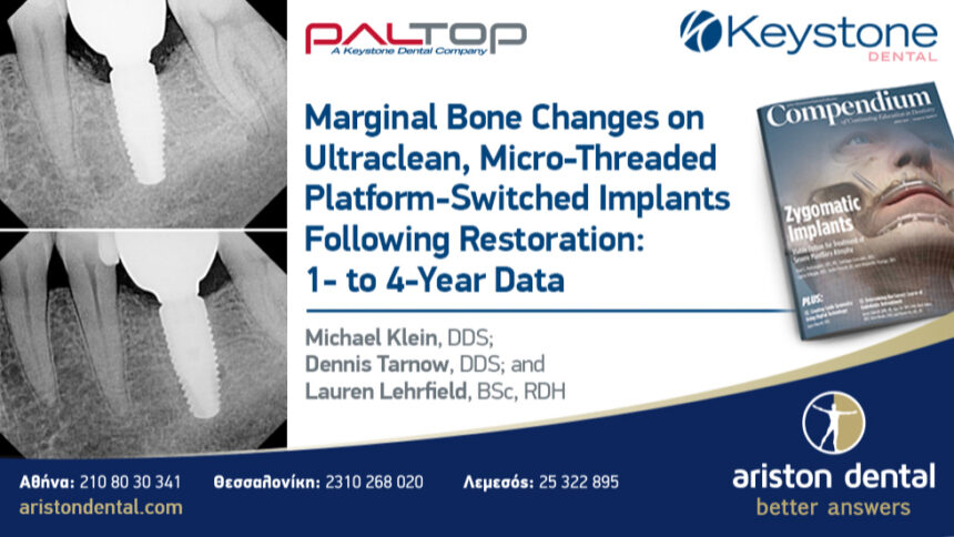 Marginal Bone Changes on Ultraclean, Micro-Threaded Platform-Switched Implants Following Restoration: 1- to 4-Year Data
