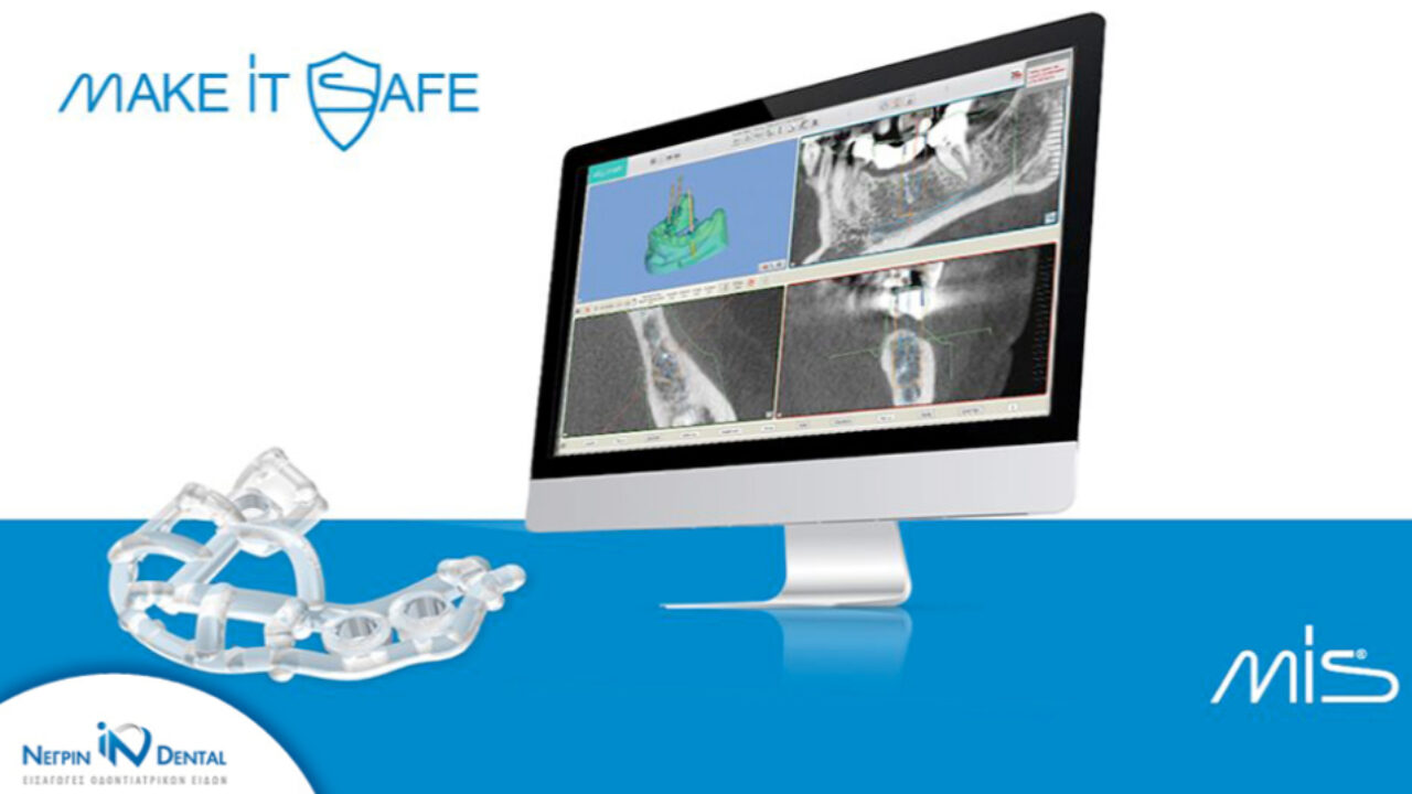 MGuide MIS | Απλότητα και ακρίβεια στην Ψηφιακή Εμφυτευματολογία | ΝΕΓΡΙΝ ΙΝ Dental