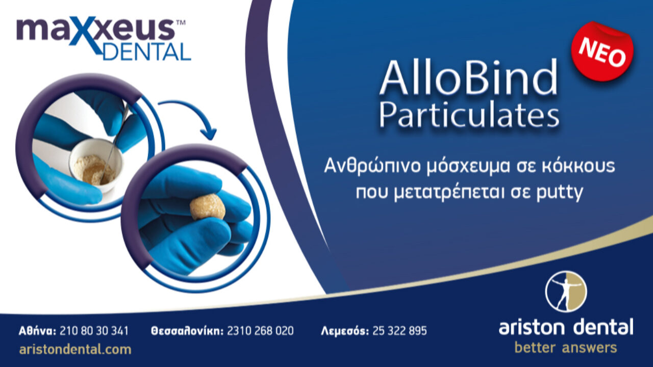 AlloBind Particulates - Ανθρώπινο μόσχευμα σε κόκκους που μετατρέπεται σε putty