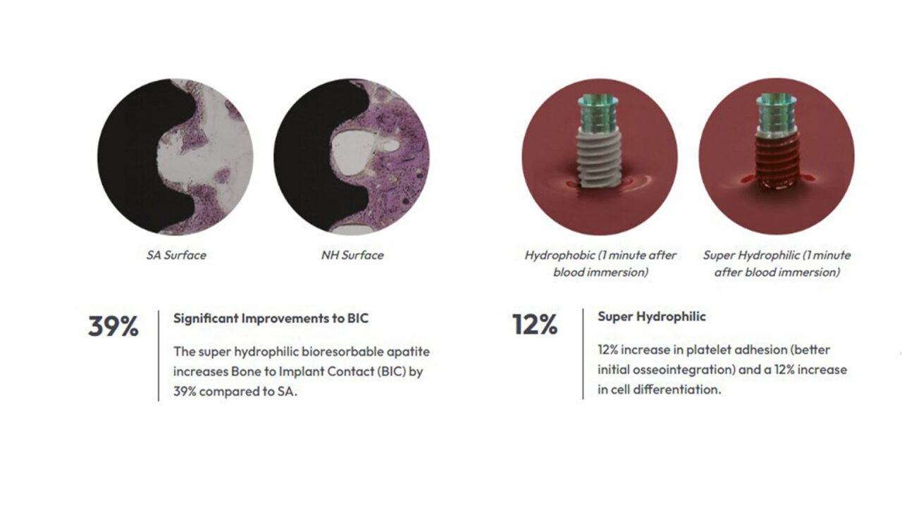 Anthos Hellas - Hiossen με νέα επιφάνεια ΝΗ