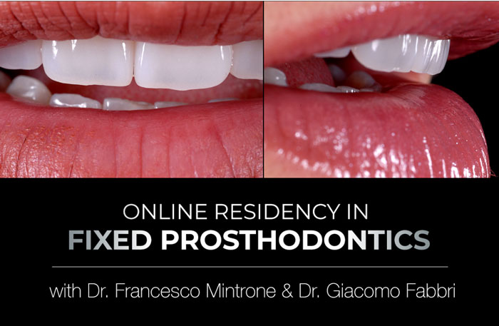 Online Residency Program in Fixed Prosthodontics - Esthetic and Functional Rehabilitation of Natural Teeth