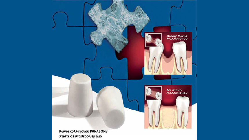 Κώνοι κολλαγόνου PARASORB© - Χτίστε σε σταθερό θεμέλιο