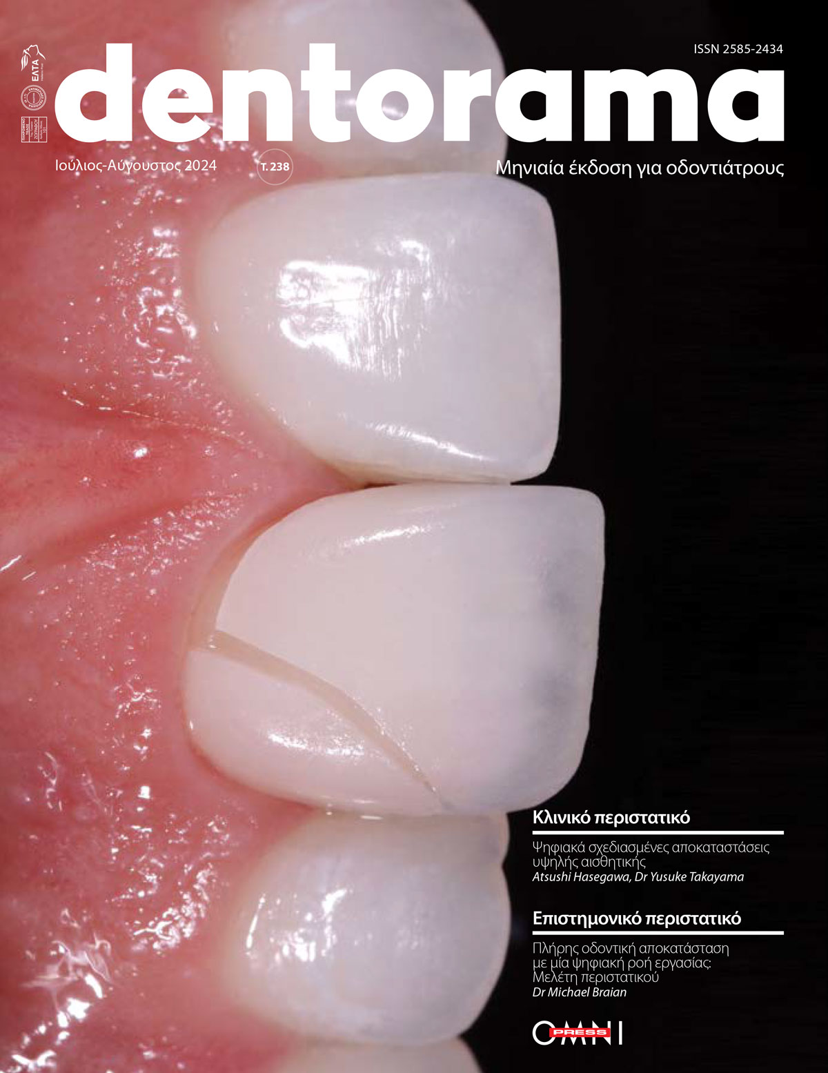 Dentorama