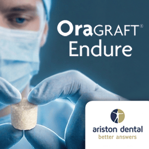 Sticky Bone – (changed to oragraft endure) Side