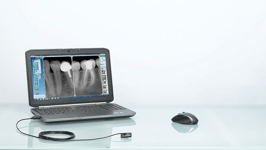 Ψηφιακή ακτινογραφία με σένσορα Opteo