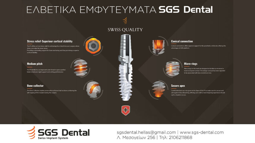 SGS Dental εμφυτεύματα: Τέλεια βιοσυμβατότητα, εγγύηση εφ' όρου ζωής
