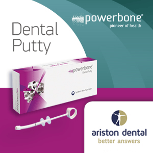 powerbone 2025 – side