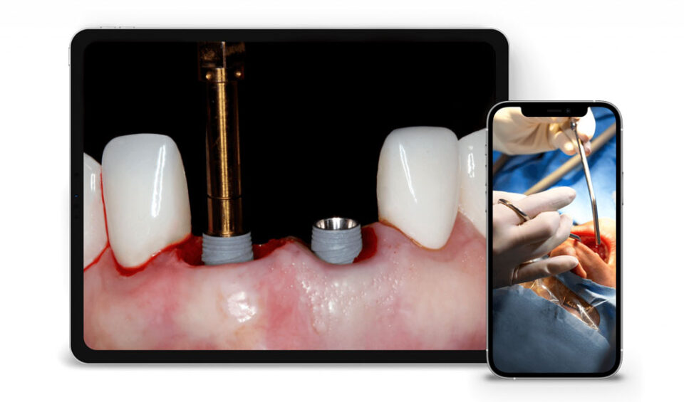 Online Residency Program: A-Z in Implant Dentistry LAUNCHING BLACK FRIDAY