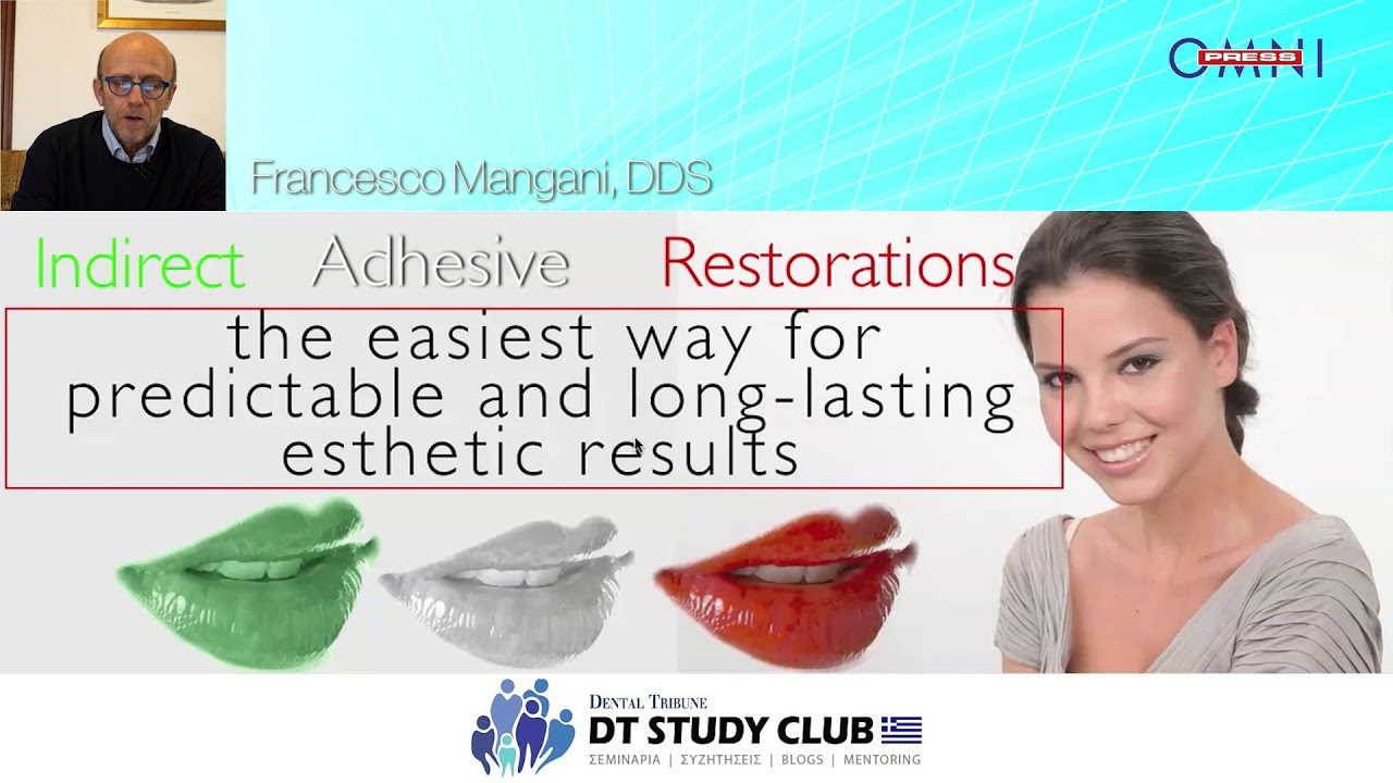 Conservative anterior restorations, Veneers Smiling Restorations