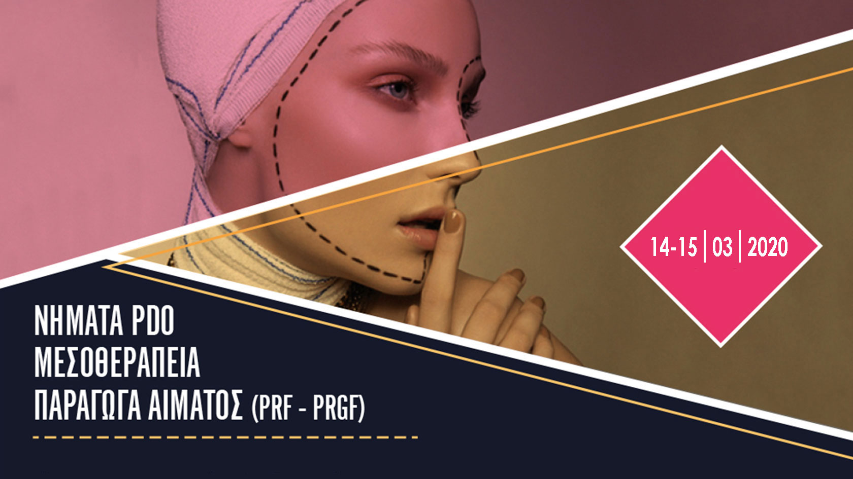 Νήματα PDO / Μεσοθεραπεία / Παράγωγα αίματος (PRF-PRGF)