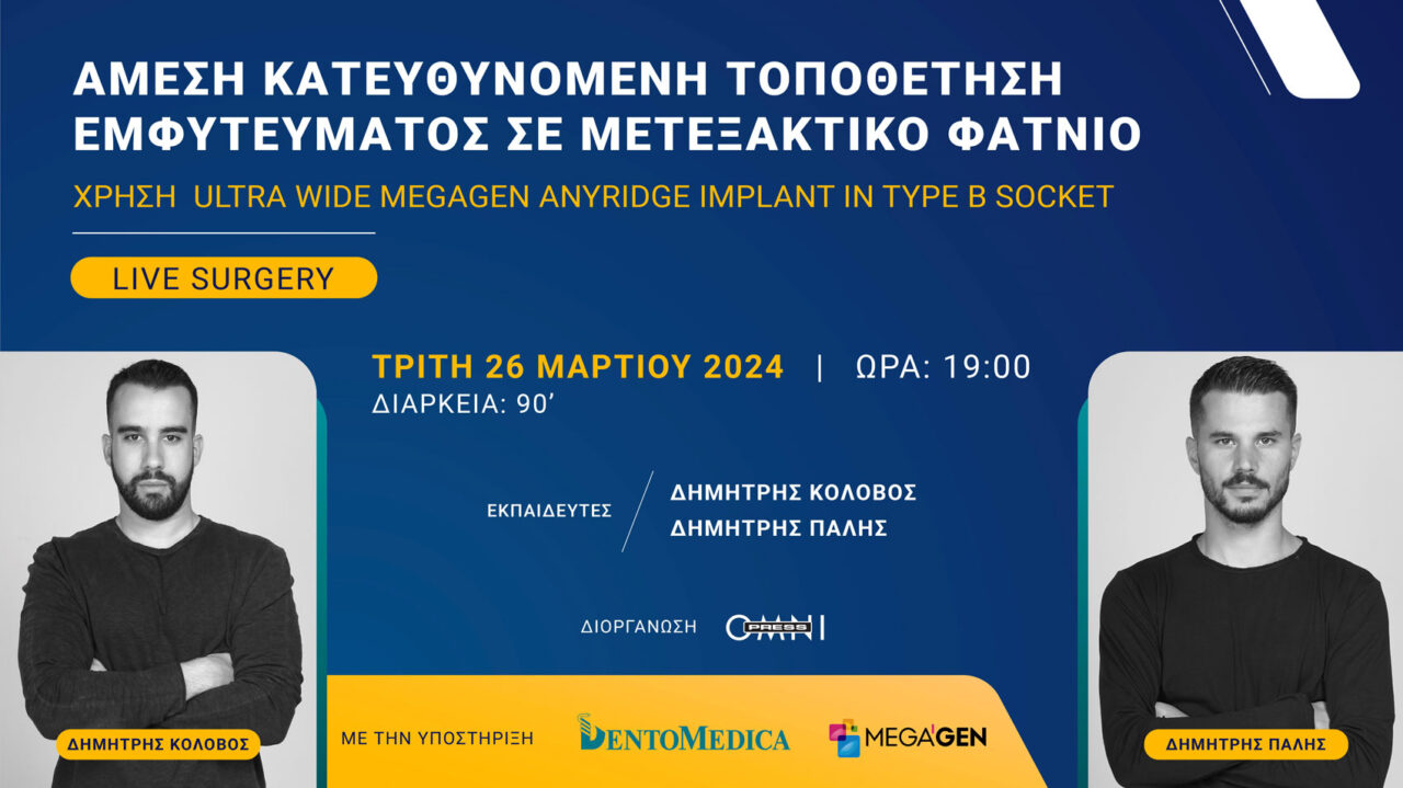 Άμεση κατευθυνόμενη τοποθέτηση εμφυτεύματος σε μετεξακτικό φατνίο. Χρήση Ultra wide Megagen Anyridge Implant in Type B socket.