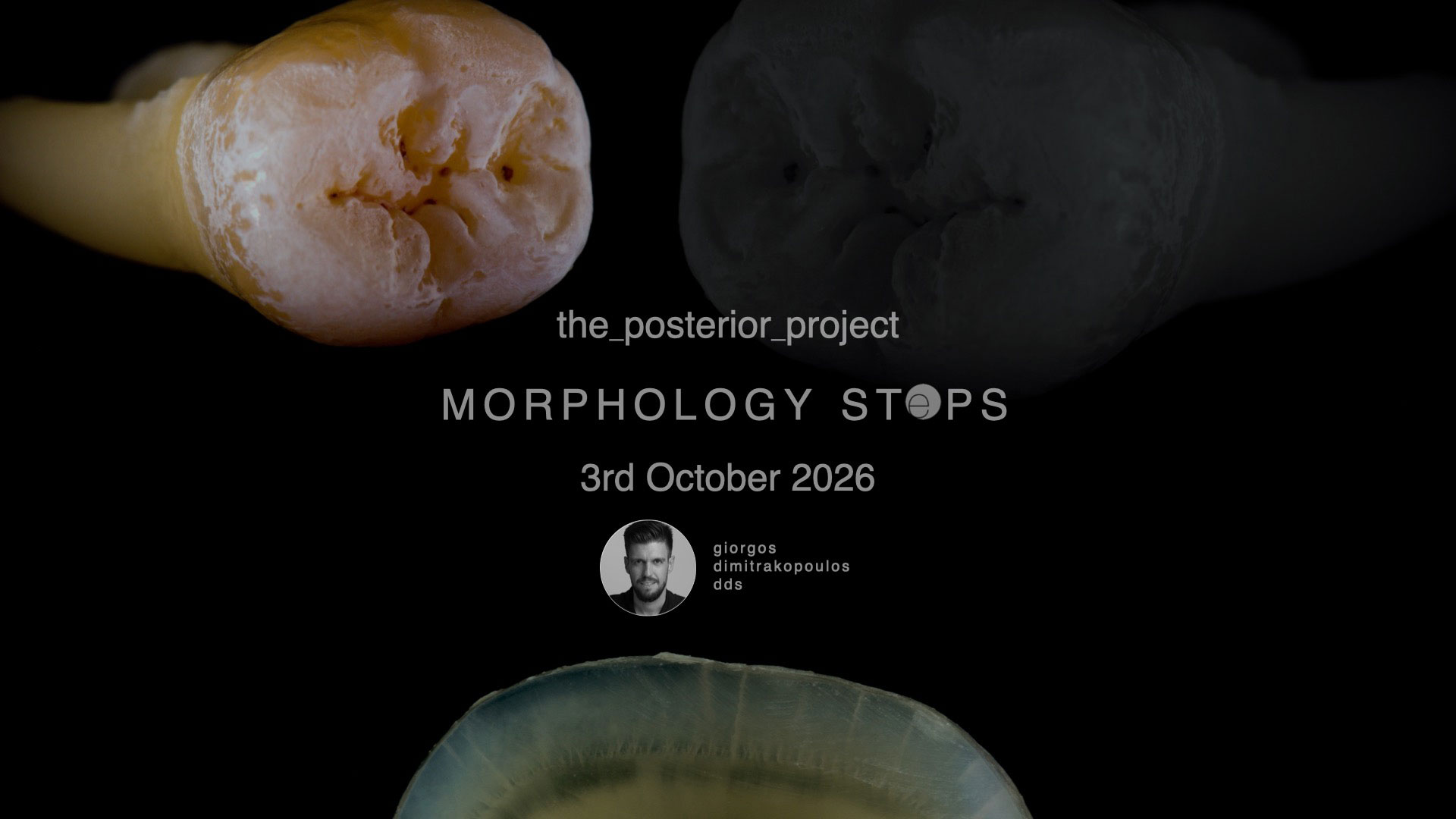 Morphology Steps