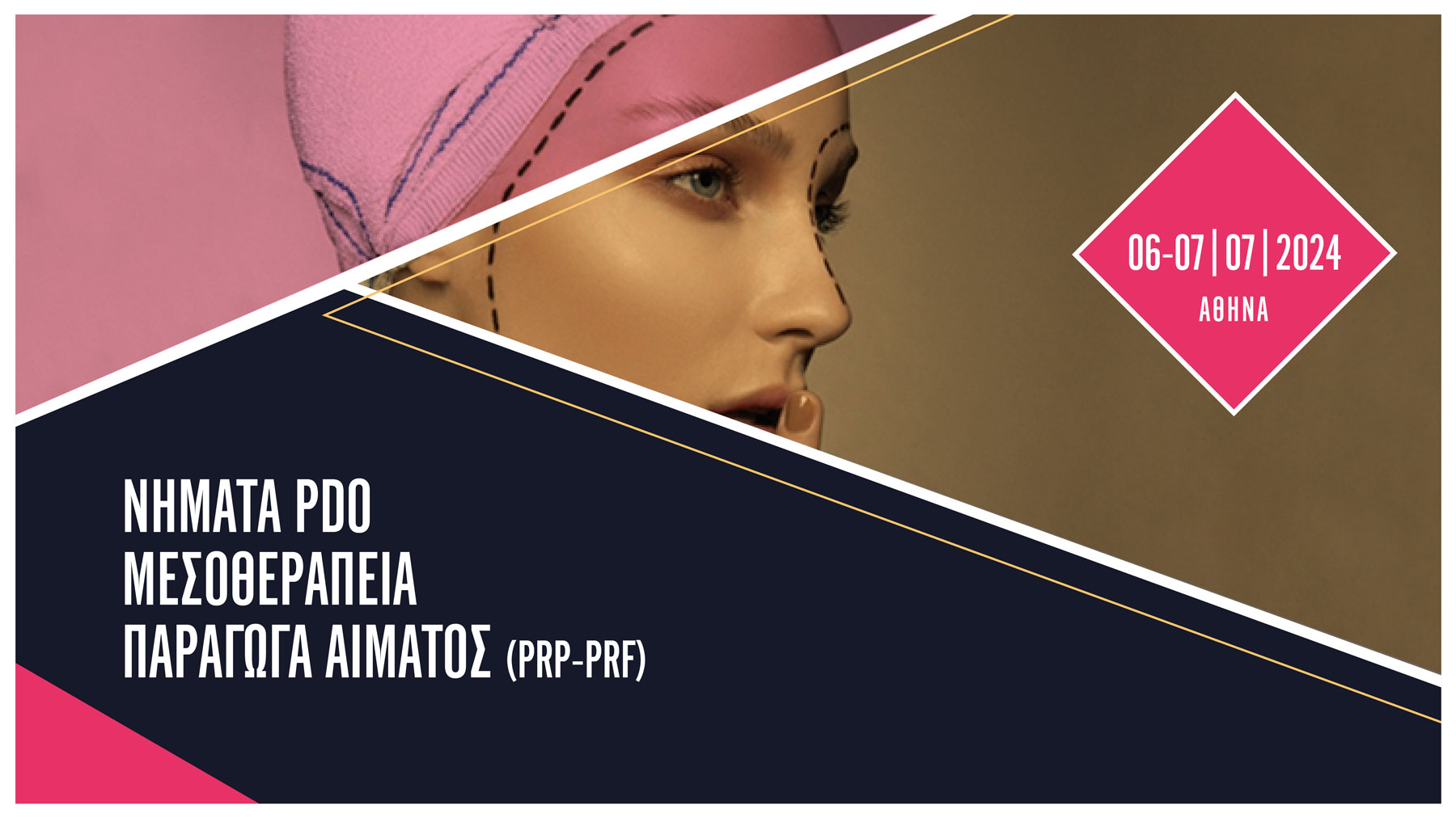 2ήμερο σεμινάριο Νήματα PDO / Μεσοθεραπεία / Παράγωγα αίματος PRP-PRF (Αθήνα)