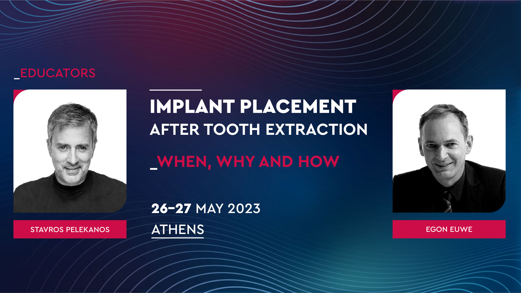 implant placement after tooth extraction– When, Why and How