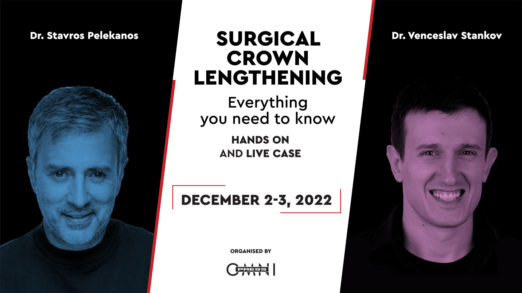 Surgical Crown lengthening - everything you need to know