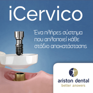 iCervico – Side