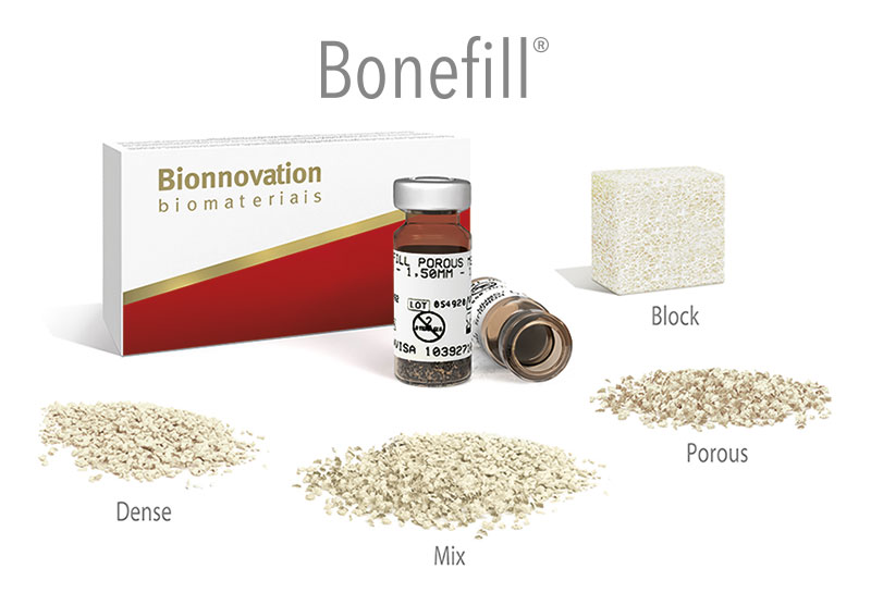 Διατήρηση του οστικού όγκου; Bonefill βόειο μόσχευμα!